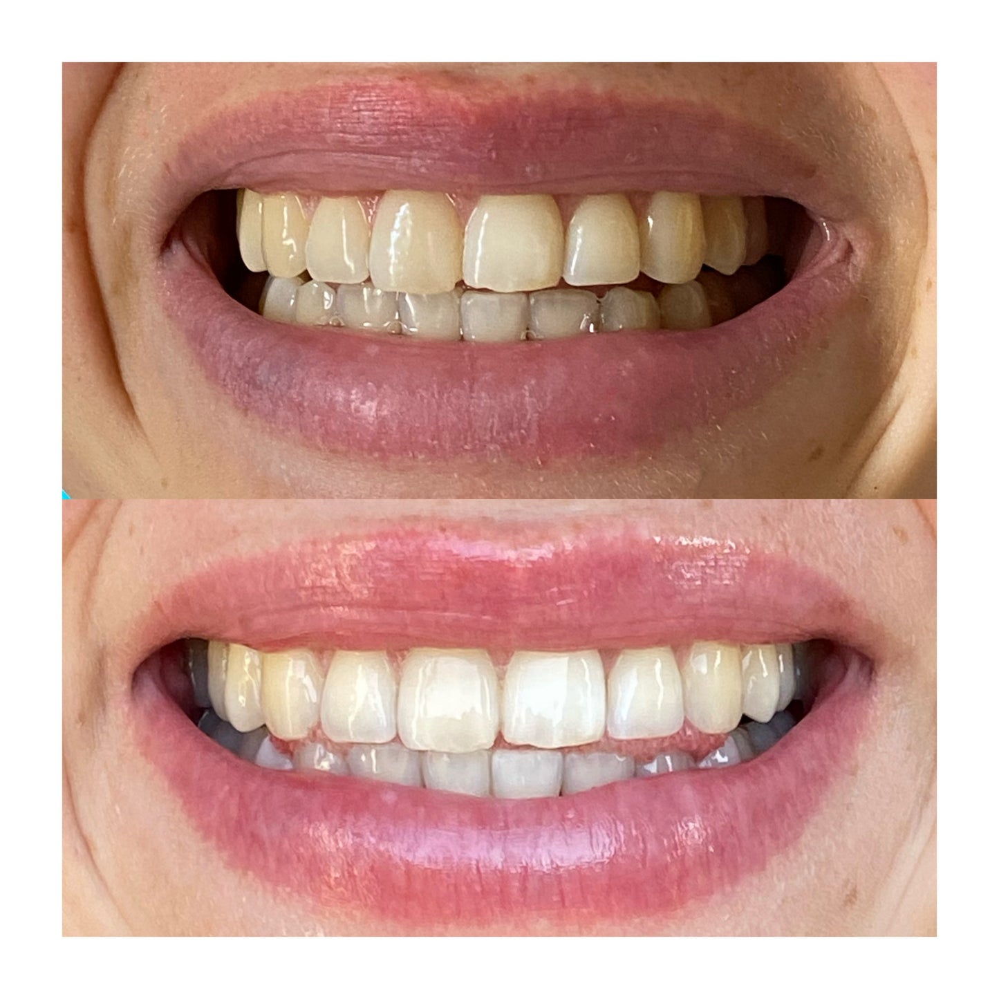 Day and Night Toothpaste Duo