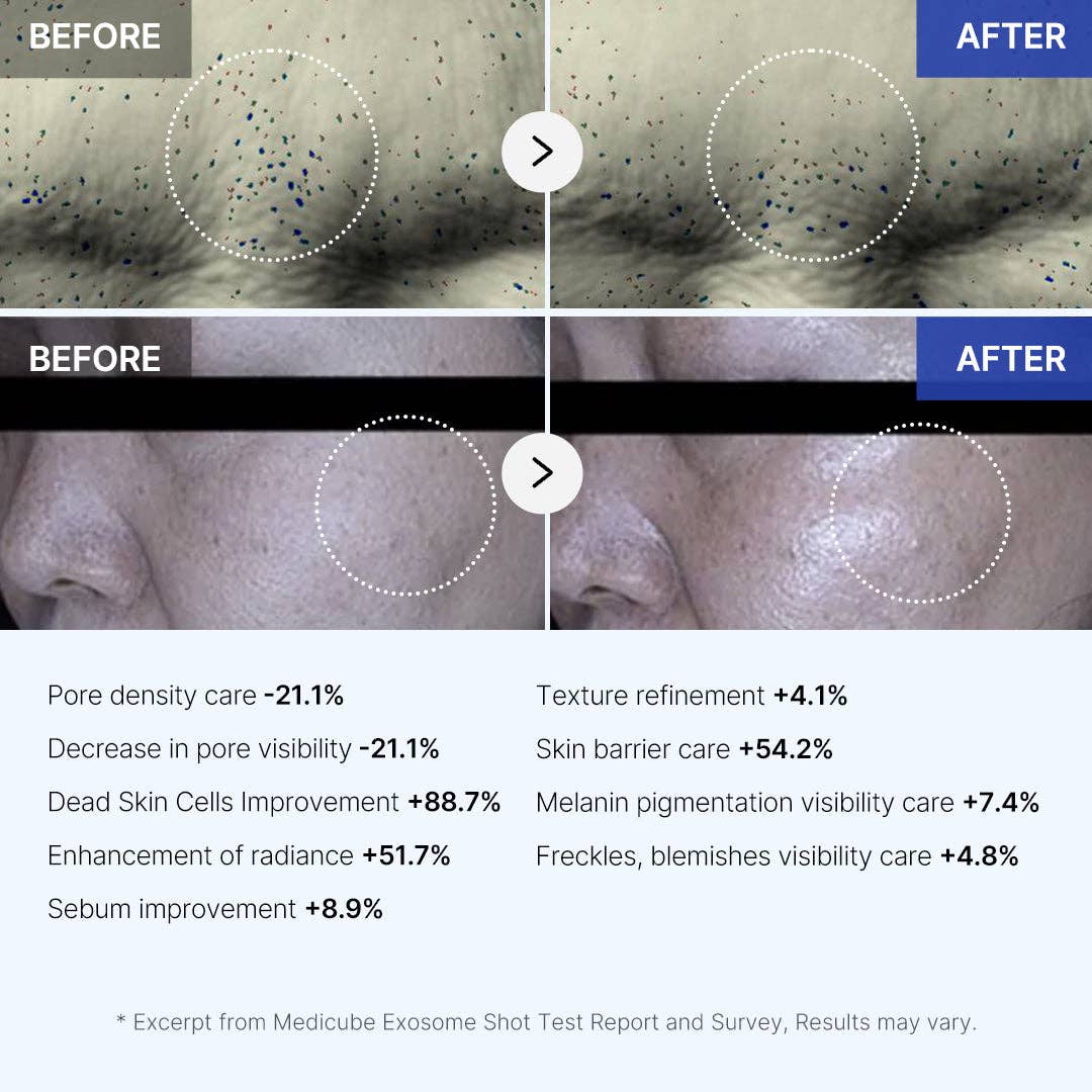 Medicube Zero Exosome Shot 2000, 30 ml