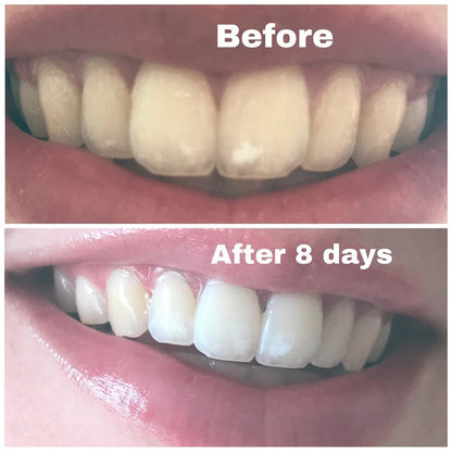 Day and Night Toothpaste Duo